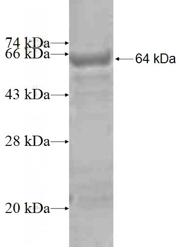 Recombinant Human CCIN SDS-PAGE