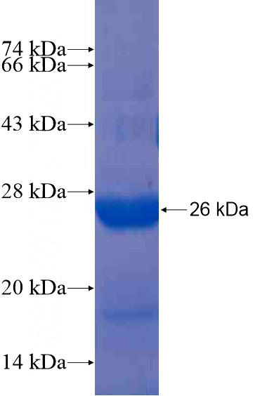 Recombinant Human RAB35 SDS-PAGE
