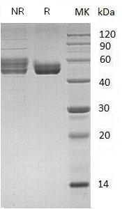 Mouse Cd74/Ii (mFc & His tag) recombinant protein