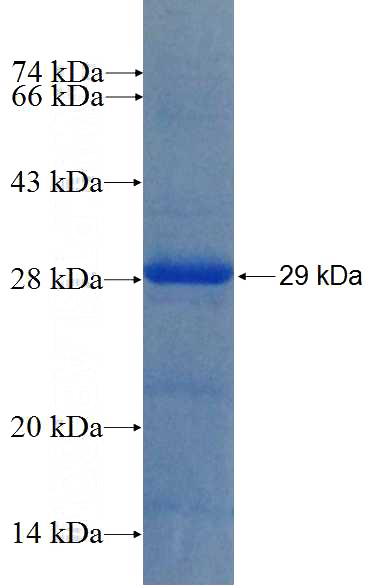 Recombinant Human RNF125 SDS-PAGE