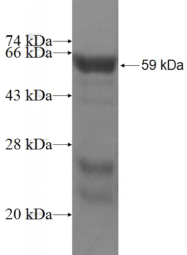 Recombinant Human RABGAP1 SDS-PAGE