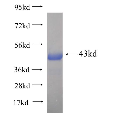 Recombinant human TAF5L SDS-PAGE