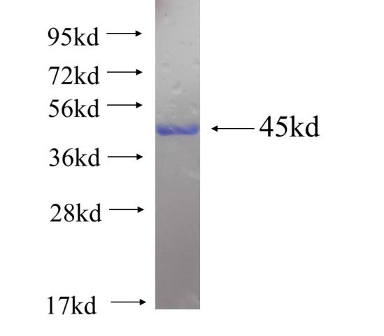 Recombinant human PRPSAP1(Full length) SDS-PAGE
