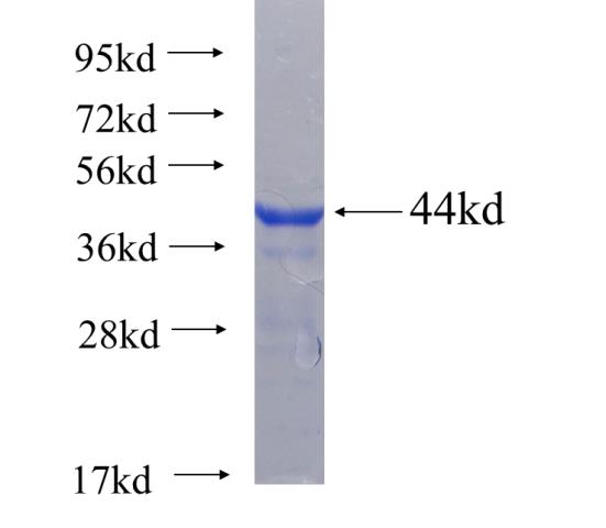 Recombinant human MUTYH SDS-PAGE