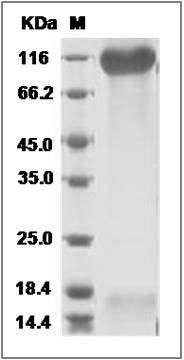Cynomolgus / Rhesus SELP / selectin P / P-selectin Protein (His Tag) SDS-PAGE
