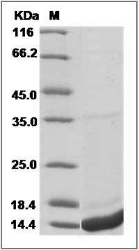 Human S100A8 / CAGA / p8 Protein (His Tag) SDS-PAGE