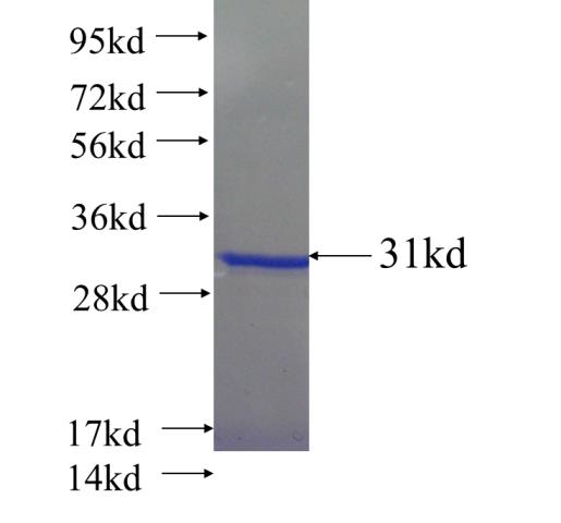 Recombinant human CCNG1 SDS-PAGE