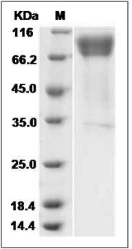 Human IL6ST / gp130 / CD130 Protein SDS-PAGE