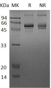 Human CSNK1G2/CK1G2 (His tag) recombinant protein