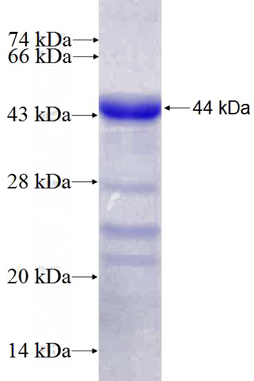 Recombinant Human GRAP2 SDS-PAGE