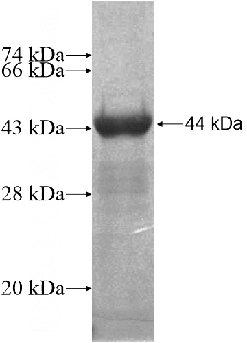 Recombinant Human KIAA0391 SDS-PAGE