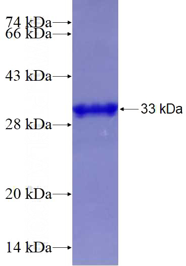 Recombinant Human APOC1 SDS-PAGE