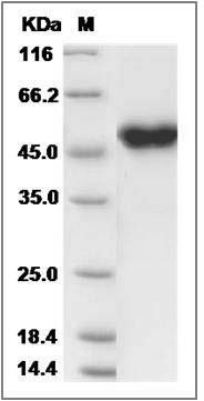 Human CRELD1 Protein (His Tag) SDS-PAGE