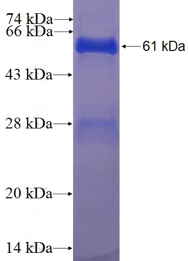 Recombinant Human RDH12 SDS-PAGE