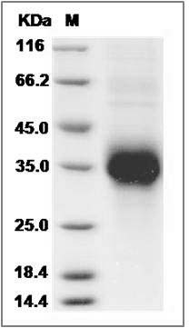 Rat TNFR1 / CD120a / TNFRSF1A Protein (His Tag) SDS-PAGE