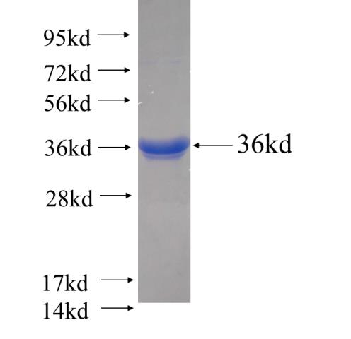 Recombinant human UQCRFS1(Full length) SDS-PAGE