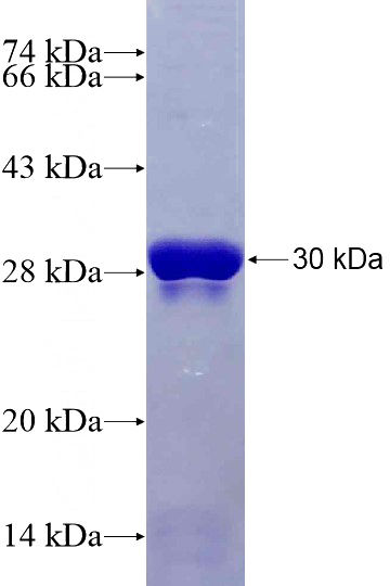 Recombinant Human RALB SDS-PAGE