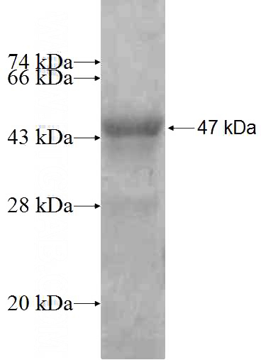 Recombinant Human ARFGAP2 SDS-PAGE
