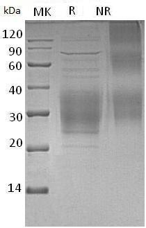 Mouse Trem2/Trem2a/Trem2b/Trem2c (His tag) recombinant protein