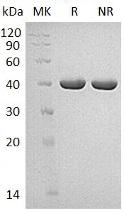Human CHI3L2 (His tag) recombinant protein
