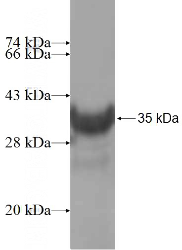 Recombinant Human ANAPC13 SDS-PAGE