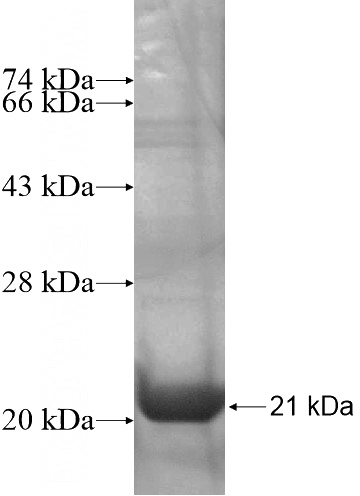 Recombinant Human RP11-257K9.7 SDS-PAGE