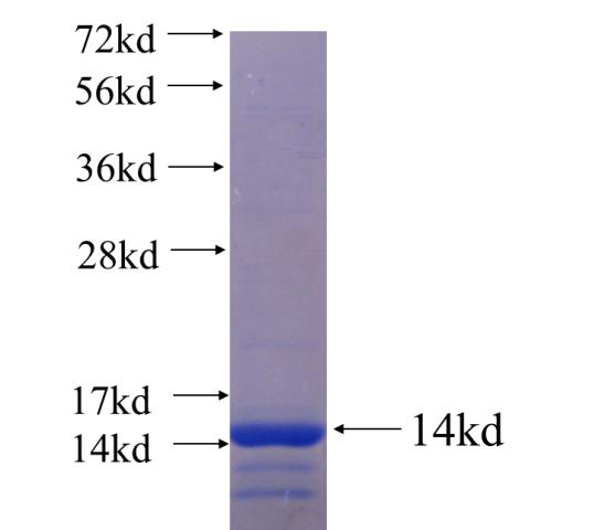 Recombinant human HDAC7 SDS-PAGE