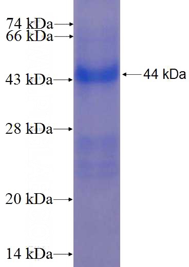 Recombinant Human MDGA1 SDS-PAGE