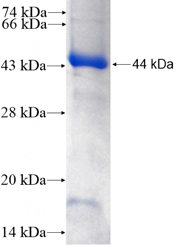Recombinant Human CXorf22 SDS-PAGE