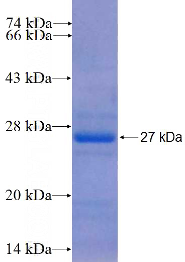 Recombinant Human C17orf57 SDS-PAGE