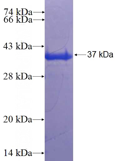 Recombinant Human RAPH1 SDS-PAGE