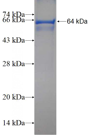 Recombinant Human AVIL SDS-PAGE