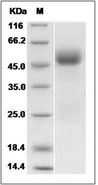 Human IL1R2 / IL1RB / CD121b Protein SDS-PAGE