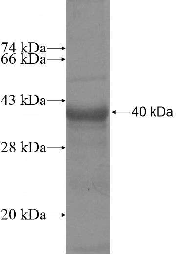 Recombinant Human RPUSD3 SDS-PAGE