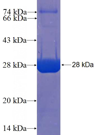Recombinant Human C1orf88 SDS-PAGE
