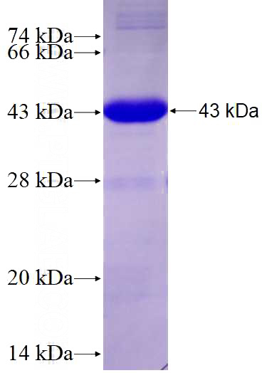 Recombinant Human SLC12A2 SDS-PAGE