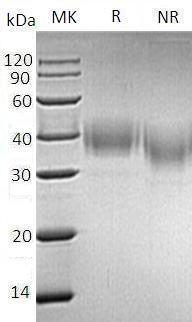 Human ESAM/UNQ220/PRO246 (His tag) recombinant protein