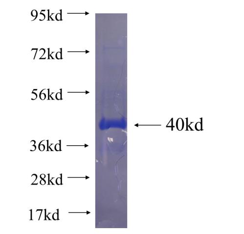 Recombinant human LGALS2 SDS-PAGE