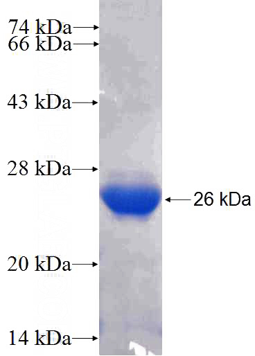 Recombinant Human DDX5 SDS-PAGE