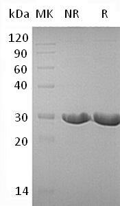 Human DTD1/C20orf88/DUEB/HARS2 (His tag) recombinant protein