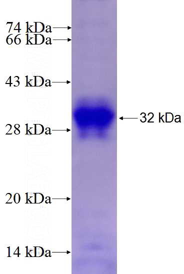 Recombinant Human USP2 SDS-PAGE