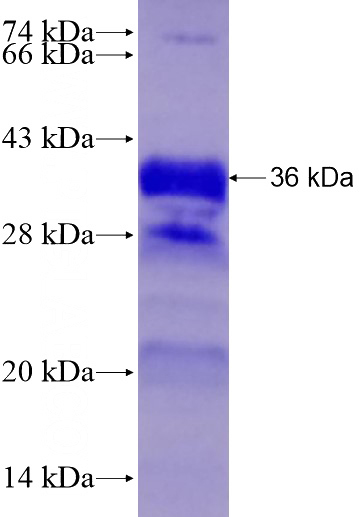 Recombinant Human LATS2 SDS-PAGE