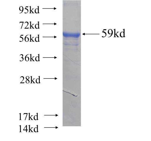 Recombinant human PEX19(Full length) SDS-PAGE