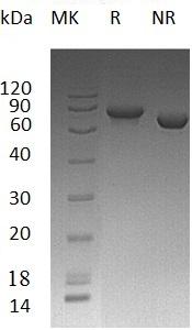 Human IFNA2/IFNA2A/IFNA2B/IFNA2C recombinant protein