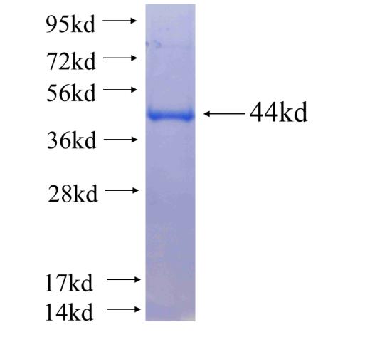 Recombinant human ARIH1 SDS-PAGE