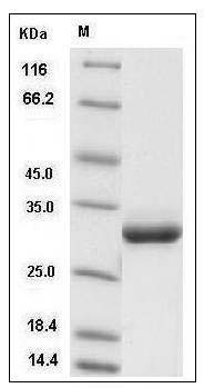 Rat Serum amyloid P component / APCS / SAP Protein (His Tag) SDS-PAGE