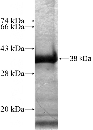 Recombinant Human FAM83A SDS-PAGE