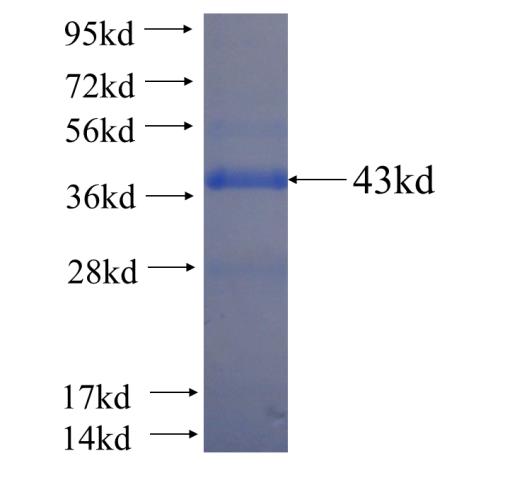 Recombinant human MTAP SDS-PAGE