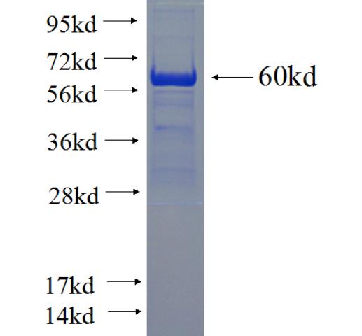 Recombinant human DCUN1D3 SDS-PAGE