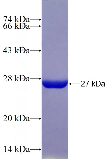 Recombinant Human SAMD9 SDS-PAGE